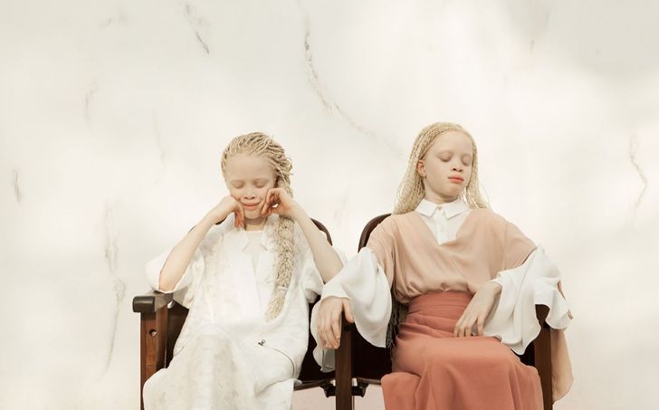 The Utterly Unique Appearance of These Twins Has Stunned the Internet