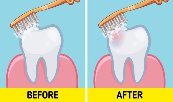 Zubní lekári konečne vyriešia debatu o tom, či by ste si mali zuby umývať pred alebo po raňajkách