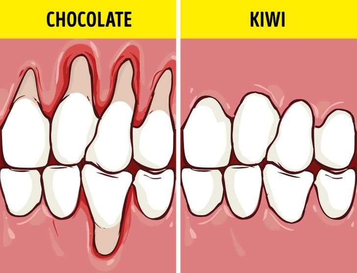 ทำอย่างไรให้เรามีฟันขาวอย่างเป็นธรรมชาติและแข็งแรงสุขภาพดี?