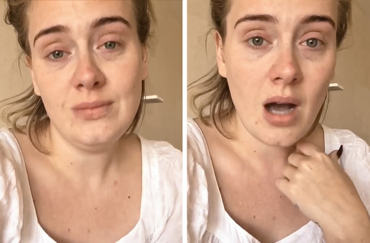 Adele Reveals She's Battling Serious Infection Caused by 'Sitting in Her  Sweat' / Bright Side