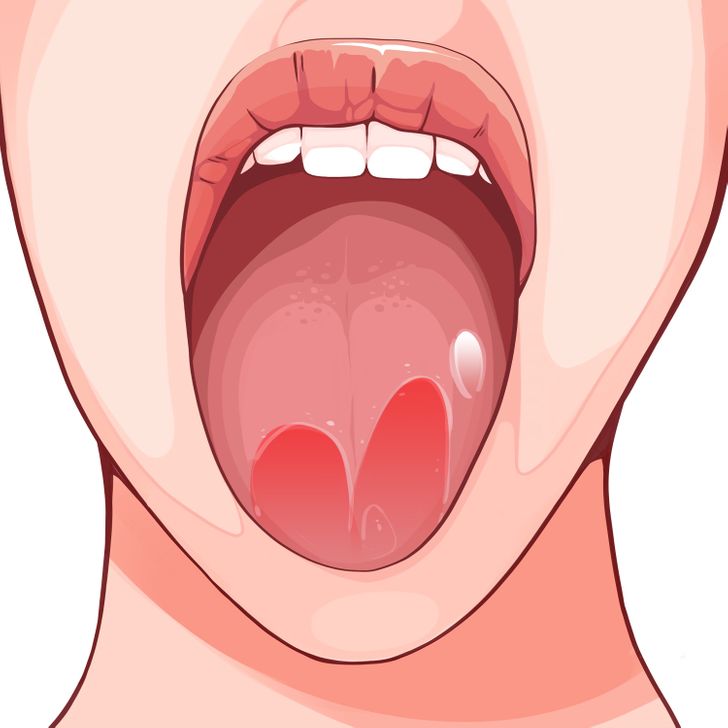 6 Things Your Tongue Can Reveal About Your Health