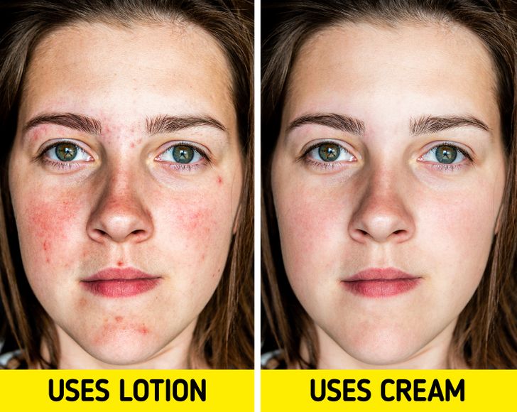 10 Tips for How to Deal With Red, Irritated Skin / Bright Side