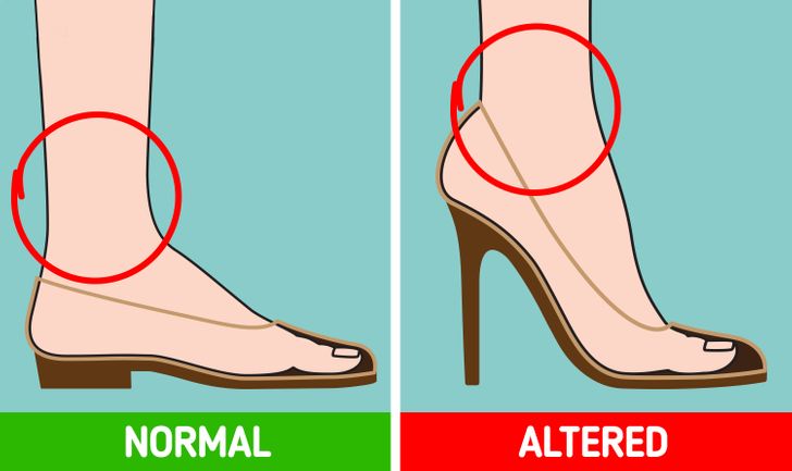 What Can Happen to Your Body If You Wear High Heels Every Day
