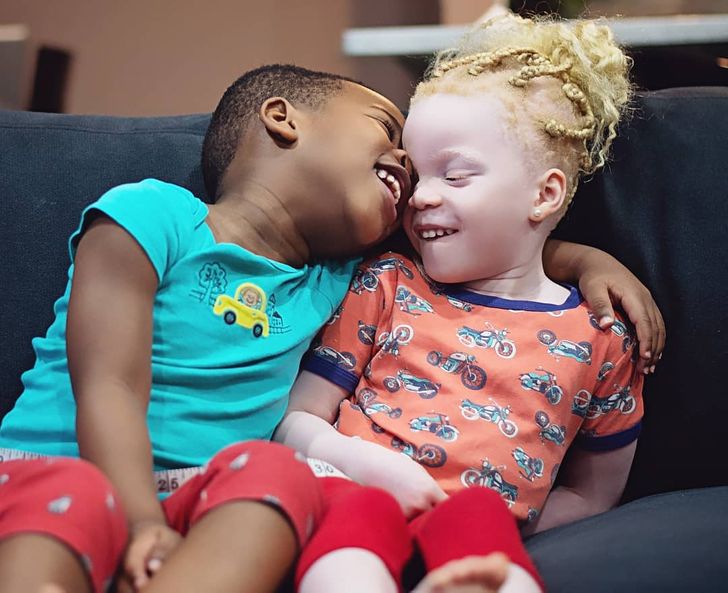 Twins With Different Skin Colors Astonished Their Mom When They Were Born