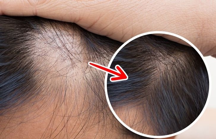 10 Reasons Why Your Hair Is Falling Out and How to Stop It