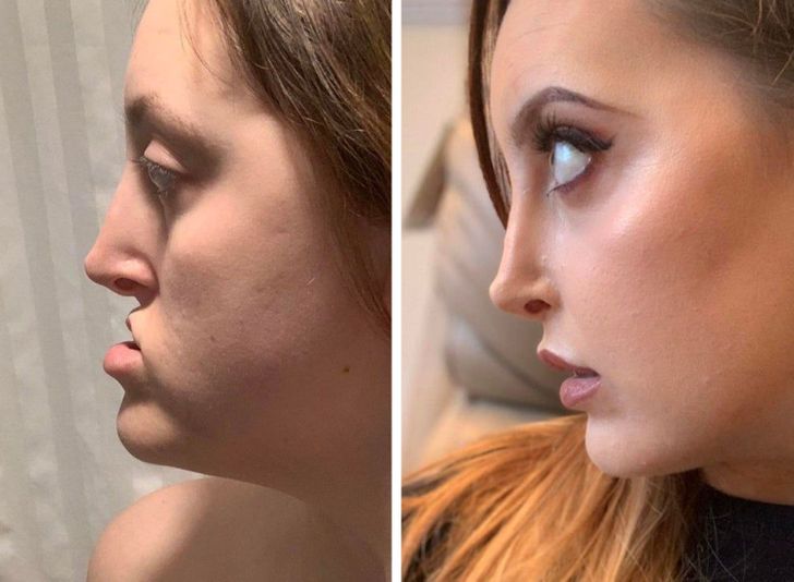 20 People That Got Plastic Surgery and Are Rocking Their New Looks