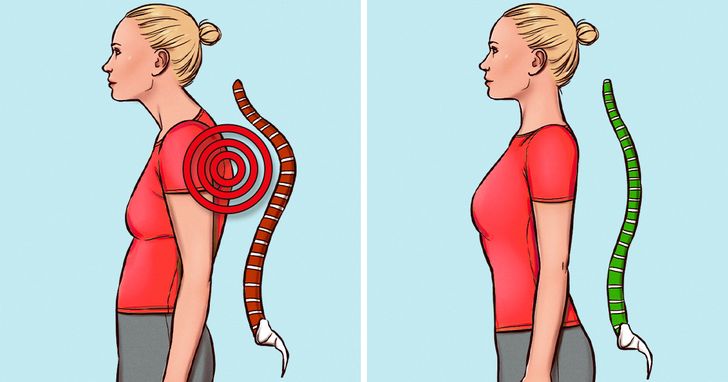 8 Simple Exercises to Improve Your Posture and Reduce Back Pain