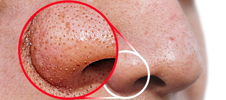8 Awesome Beauty Ideas to Keep You Looking Great