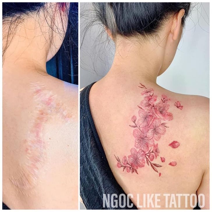 A Vietnamese Artist Uses Her Magical Touch to Help People Regain Self-Confidence by Covering Their Scars With Art