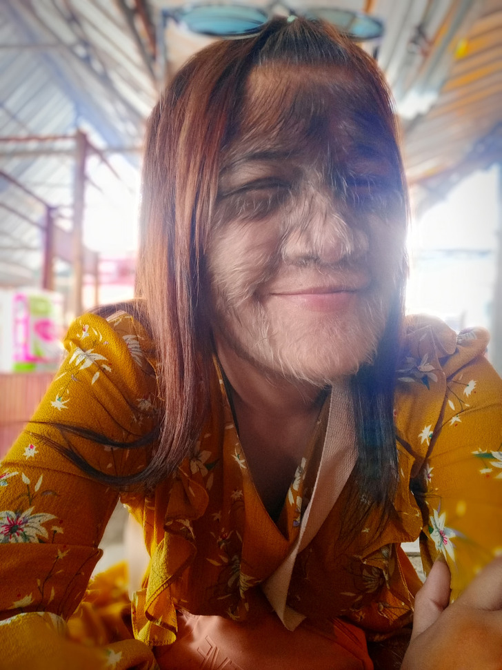 Her parents treated her just like any other kid, and they never made her feel like she was less important. A young womain in a yellow floral top smiles for the camera, her face covered in fur-like hair.