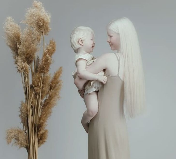 Albino Sisters Born 12 Years Apart Excite the Internet With Their Photos