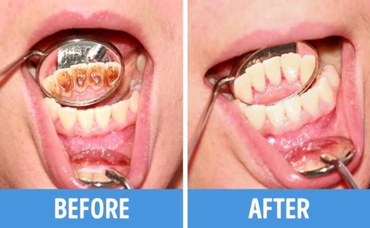 8 Major Mistakes We Make When Taking Care of Our Teeth