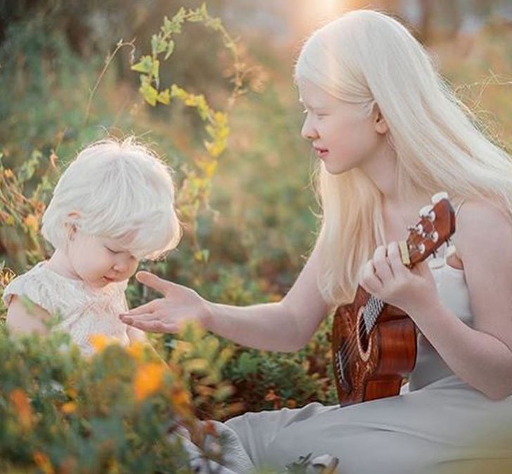 Albino Sisters Born 12 Years Apart Excite the Internet With Their Photos