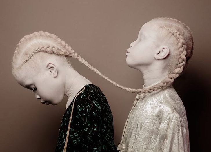 The Utterly Unique Appearance of These Twins Has Stunned the Internet