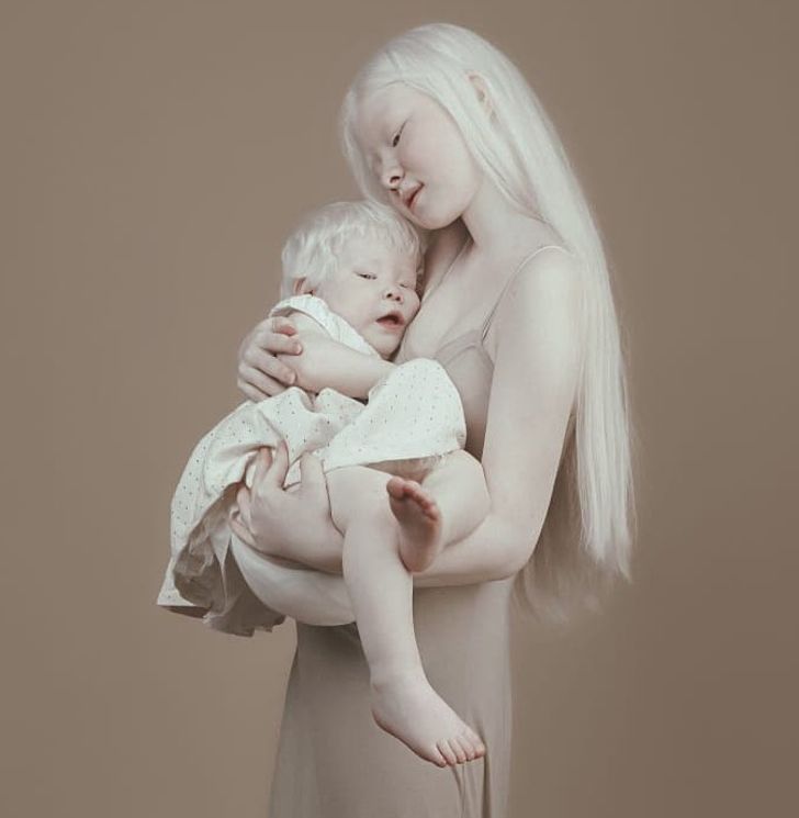 Albino Sisters Born 12 Years Apart Excite the Internet With Their Photos