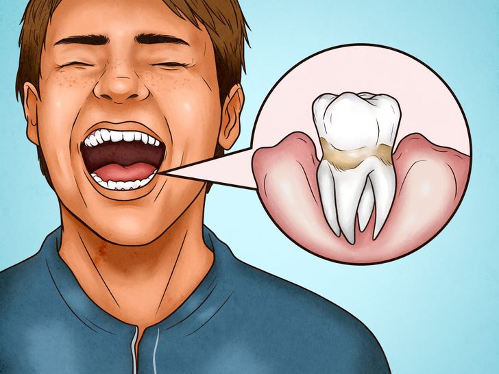 Dişlerinizi Çok Sert Fırçaladığınızın 4 İşareti ve Düzeltebileceğiniz 4 Yol