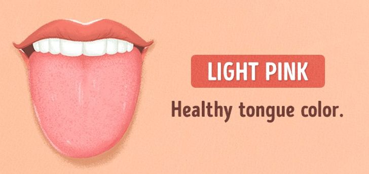 13 Things Your Tongue Is Trying to Tell You About Your Health