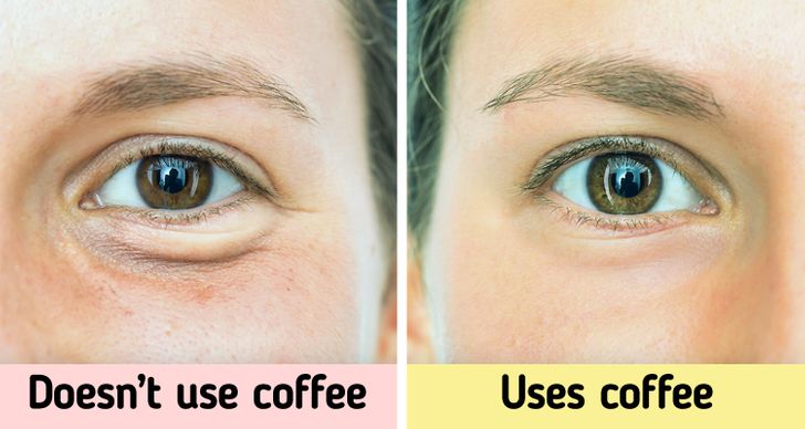 8 Tips to Reduce Black Circles and Tiredness Under the Eyes