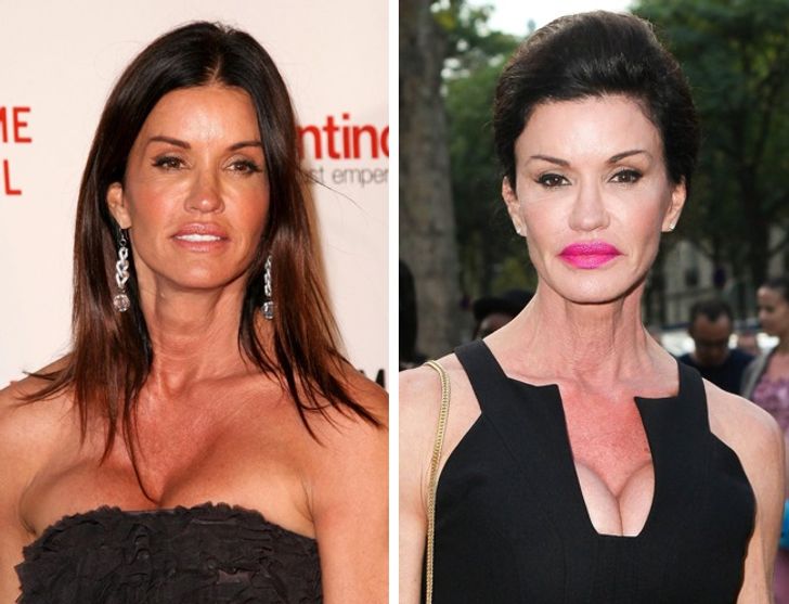 How Plastic Surgery Dramatically Changed These Celebrities