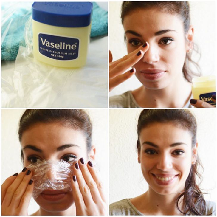 8 Natural Ways to Get Rid of Blackheads and Whiteheads Fast