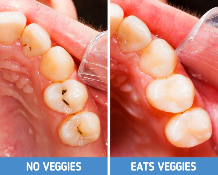 What Will Happen to Your Body If You Stop Eating Fruits and Veggies Completely