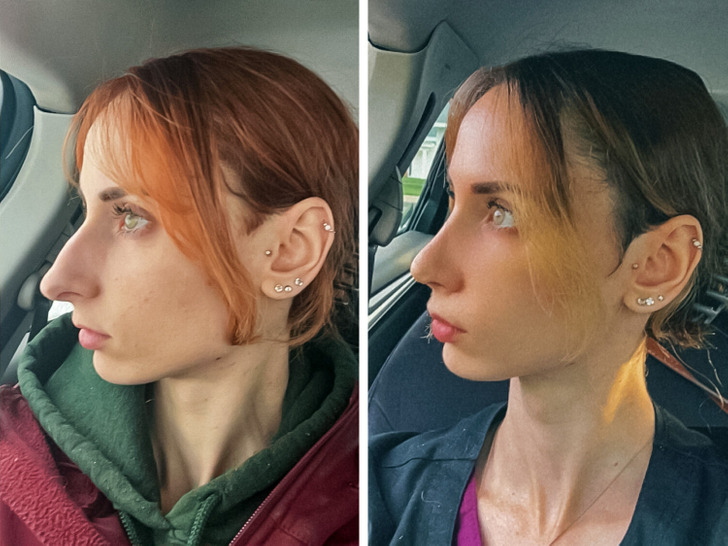 230c94500bb76f99f9ef470de4 13 Before-and-After Photos That Tell a Whole Story / Bright Side