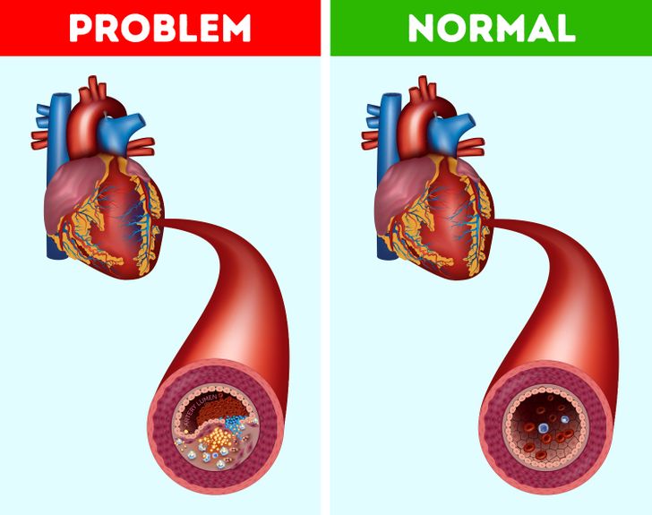 What Will Happen to Your Body If You Start Eating 3 Dates Every Day for a Week