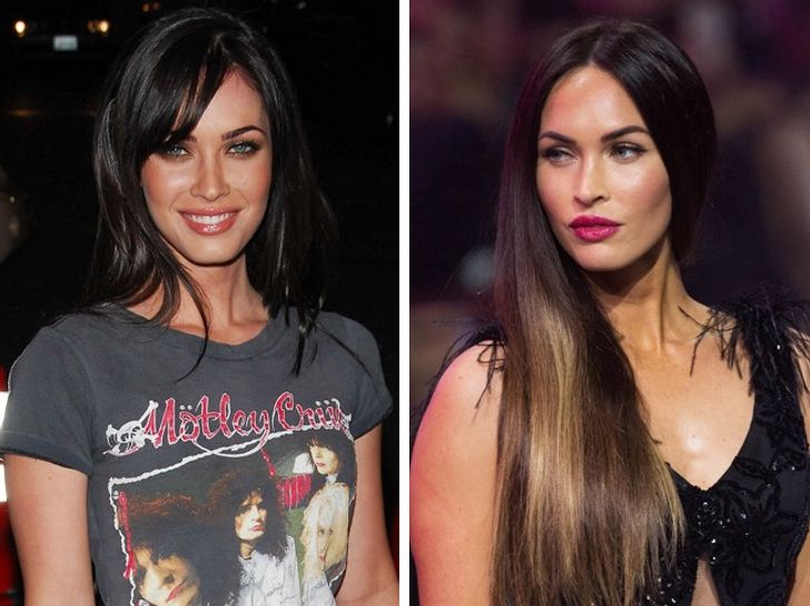 How Plastic Surgery Dramatically Changed These Celebrities
