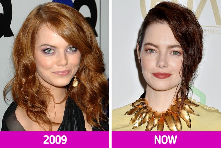 16 Stars That Worked Hard on Their Image and Look Amazing Now