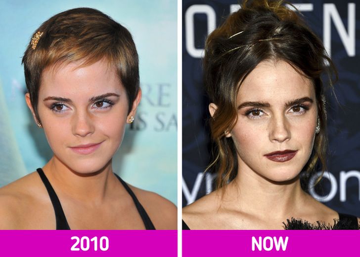 16 Stars That Worked Hard on Their Image and Look Amazing Now