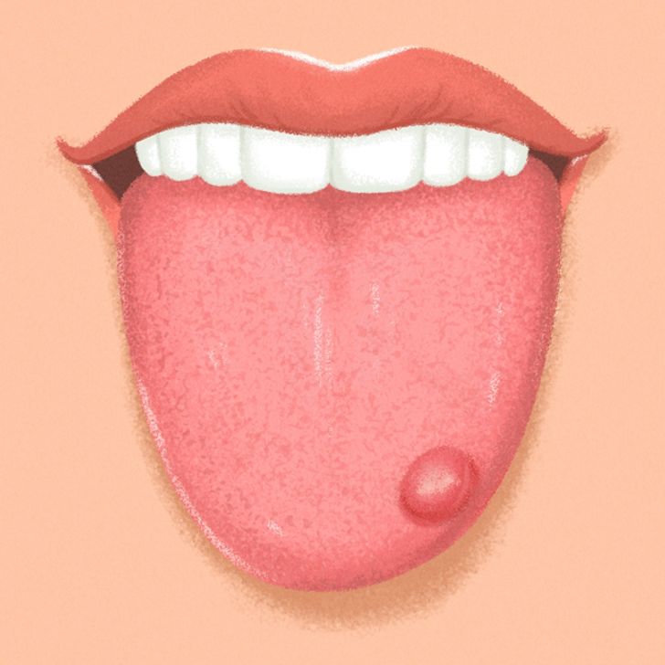 9 Things Your Tongue Is Trying to Tell You About Your Health