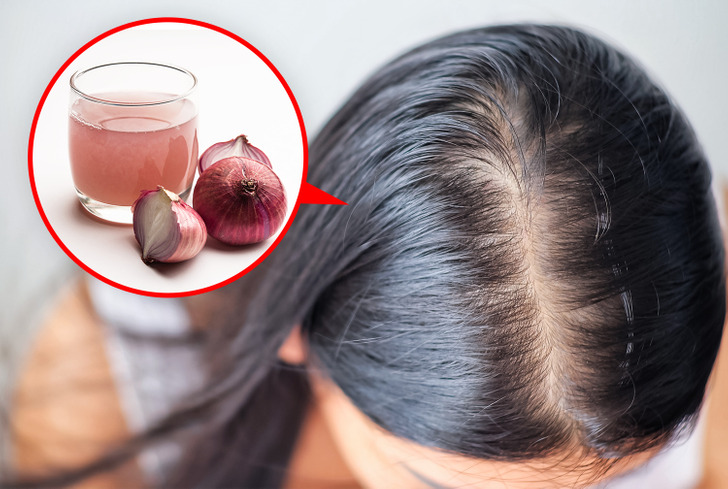 8 Remedies That Can Improve Your Hair Loss Naturally