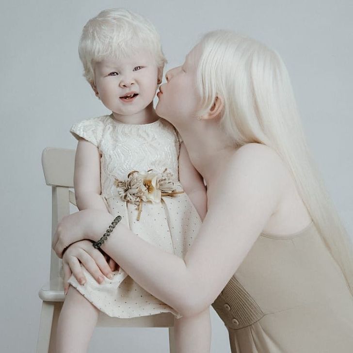 Albino Sisters Born 12 Years Apart Excite the Internet With Their Photos