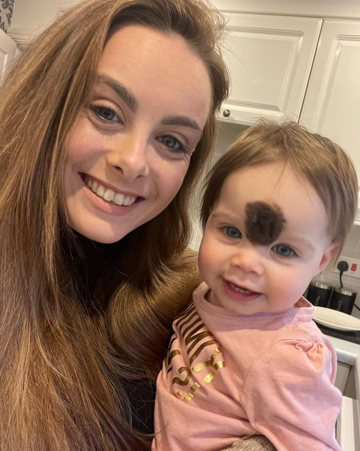 A young mom and her baby daughter, who has a brown birthmark on her forehead, taking a photo.