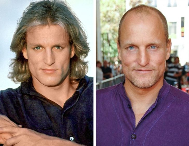 How These 12 Famous Actors Looked Before Going Bald