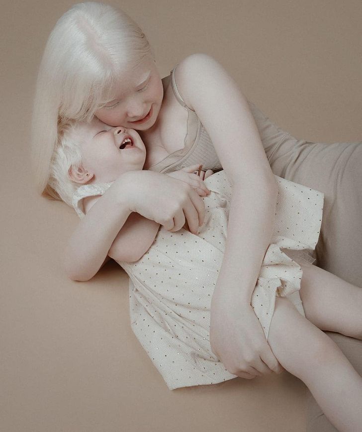 Albino Sisters Born 12 Years Apart Excite the Internet With Their Photos