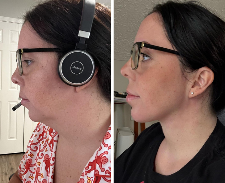 caf3f65a10ae147cfec5b11230 13 Before-and-After Photos That Tell a Whole Story / Bright Side