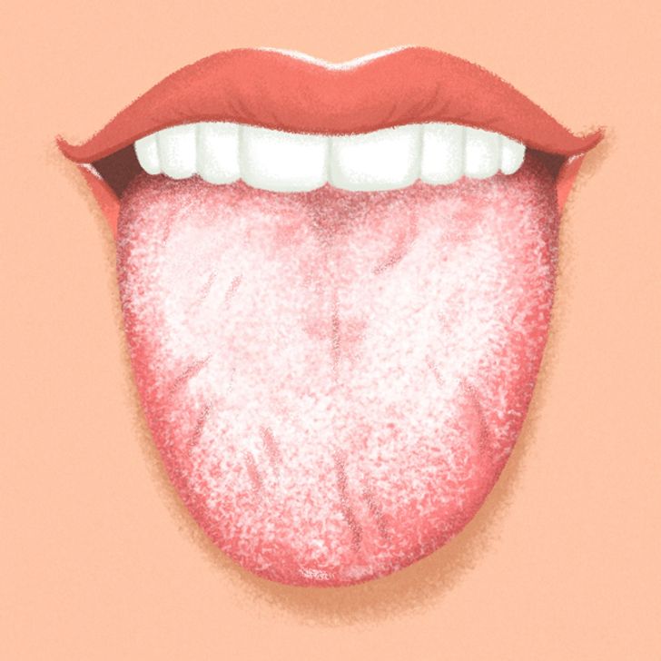 9 Things Your Tongue Is Trying to Tell You About Your Health