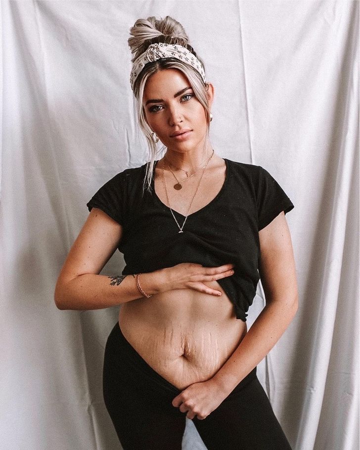4-násobná mama hrdo dokumentuje svoje telo po pôrode a stáva sa dávkou telovej pozitivity, ktorú všetci potrebujeme