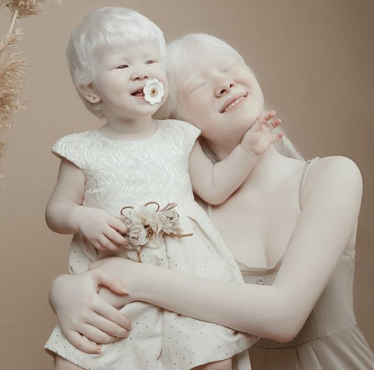 Albino Sisters Born 12 Years Apart Excite the Internet With Their Photos