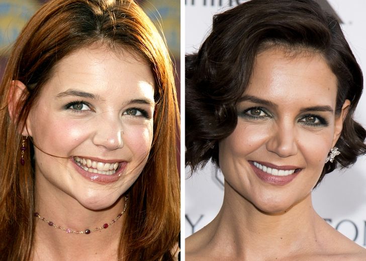 15 Celebrities That Changed Their Teeth and Can Dazzle Everyone With Their Smile / Bright Side