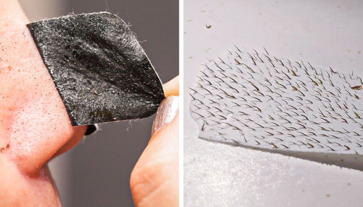 6 Things You Need to Know Before Using Pore Strips