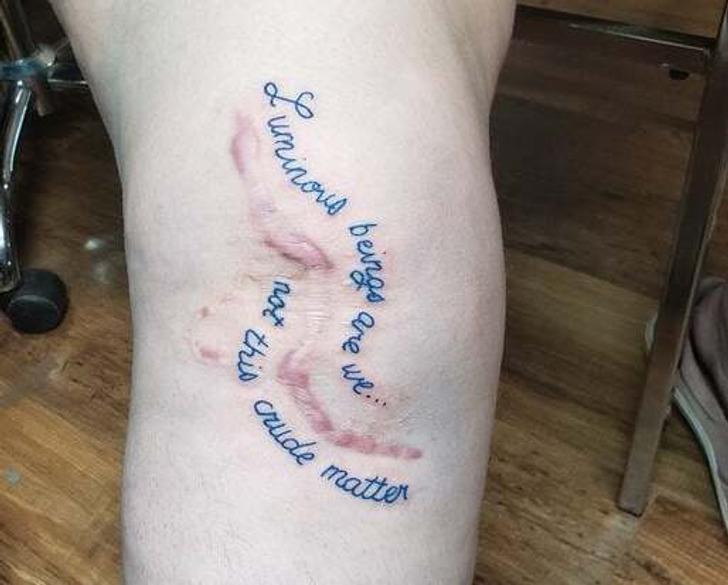 15 People Who Managed to Turn Their Scars Into Creative Works of Art ...