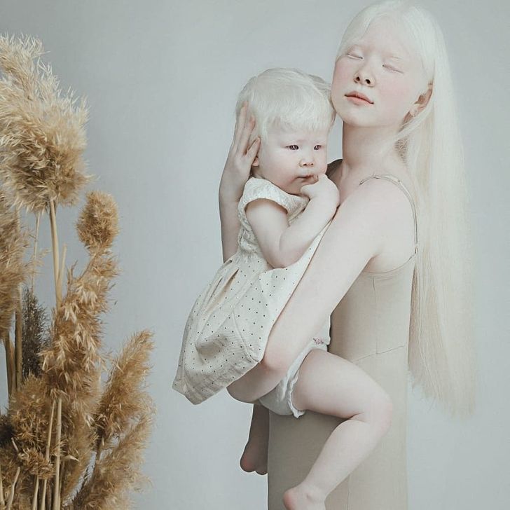 Albino Sisters Born 12 Years Apart Excite the Internet With Their Photos