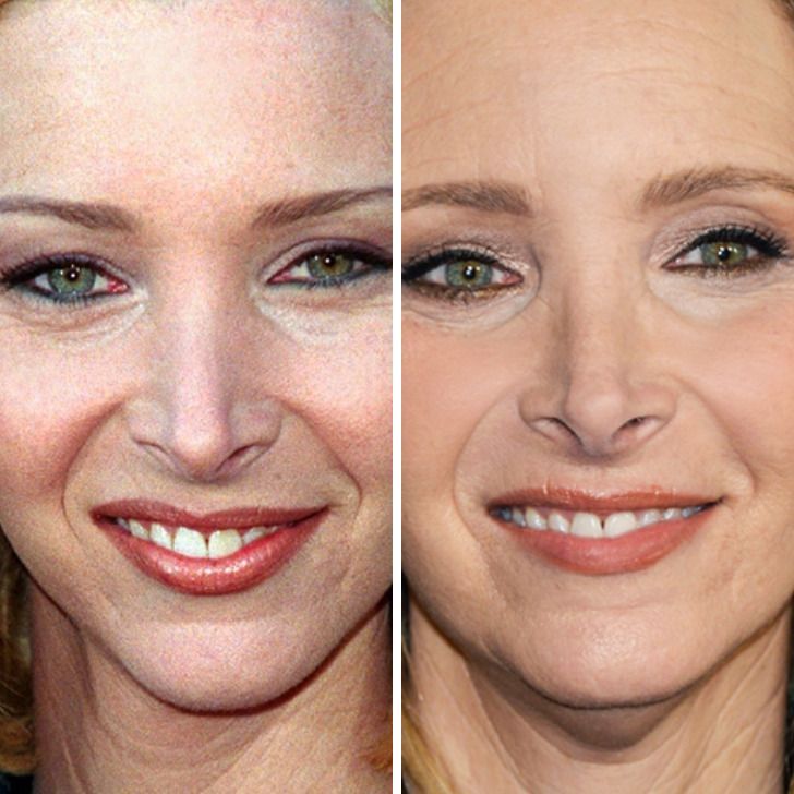 24 Close-Up Comparisons That Show How Our Favorite Celebrities Have Changed
