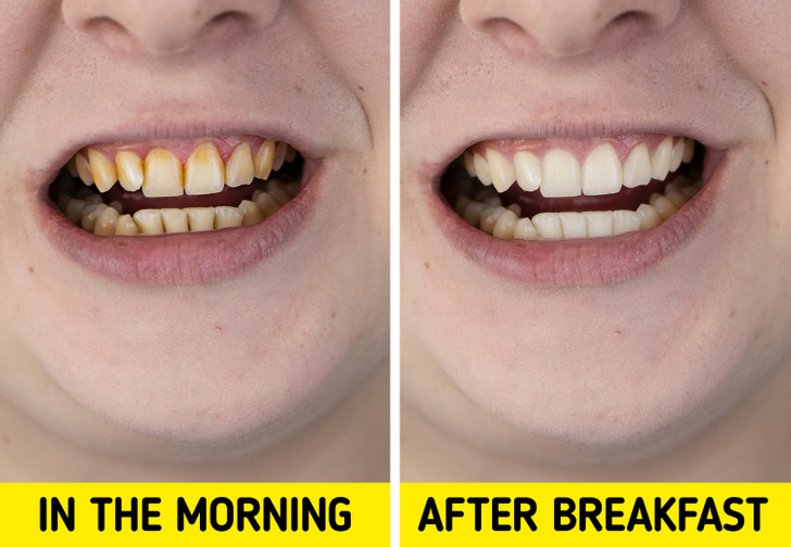 Pse mund të jetë më mirë të mos i lani dhëmbët së pari në mëngjes