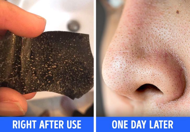 6 Things You Need to Know Before Using Pore Strips