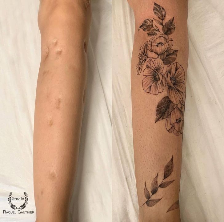 16 People Who Transformed Their Scars Into Pieces of Art