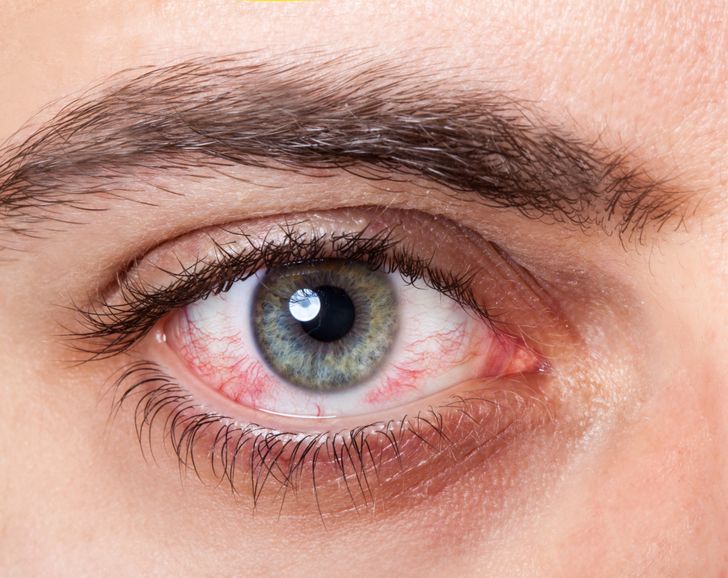 12 Things Your Eyes Can Tell About Your Health