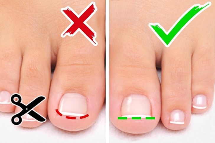 6 Awesome Tips to Make Your Feet and Toenails Look Fabulous